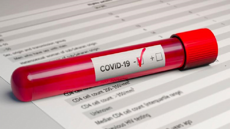 Testele pentru COVID-19 se vor face din contul poliței. Guvernul a extins lista serviciilor medicale pentru persoanele asigurate
